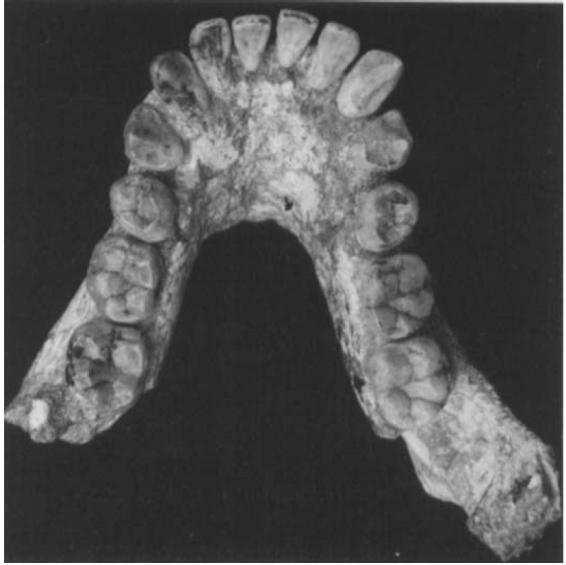 20 did not use the estimates of the coefficient of variation (C.V.) provided by Suwa et al. (2009) for some Ar. ramidus teeth, as they were based on two individuals only.