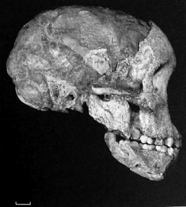 africanus is the skull with endocast of the famous 3-4 years old child from Taung (in Bromage, 1985) (Fig. 1.9), with cranial capacity of 440 cm 3 (Holloway, 2000).