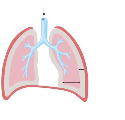 Intrapleural Pressure Pressure Relationships Negative P ip caused by opposing forces Two inward forces promote lung collapse Elastic recoil of lungs decreases lung size Surface tension of alveolar