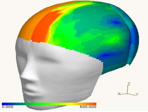 63 A tighter fit in the frontal area, and/or Ineffective spread of the impact load on the headform.