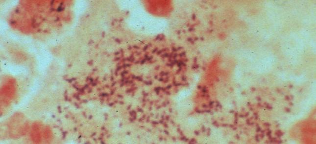 Renibacteriumsalmoninarum Bacterial