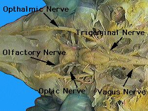 (V) The trigeminal nerve arises from the anterior end of the medulla. It is a mixed motor and sensory nerve which has four branches that inervate the face, eyes, mouth and jaws.