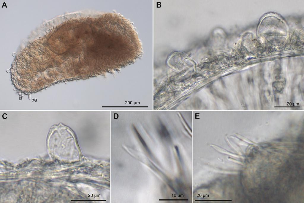 12 María Capa et al. / ZooKeys 615: 1 32 (2016) Figure 3. Euritmia carolensis sp. n., paratype, USNM 1001791, micrographs.