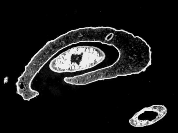 Female worm lying in male gynecophoral canal, whole mount, cross-section.