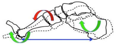 Foot mechanics for supination 4th & 5th Ray locking mechanisms Supination: Forefoot and rearfoot