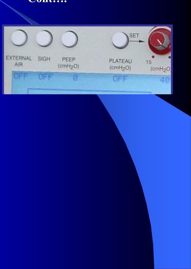 MODE and Vmin indicators: Displays operating mode and minute volume (A/C Mode).
