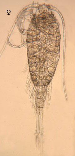 larval fish) Calanoid copepods