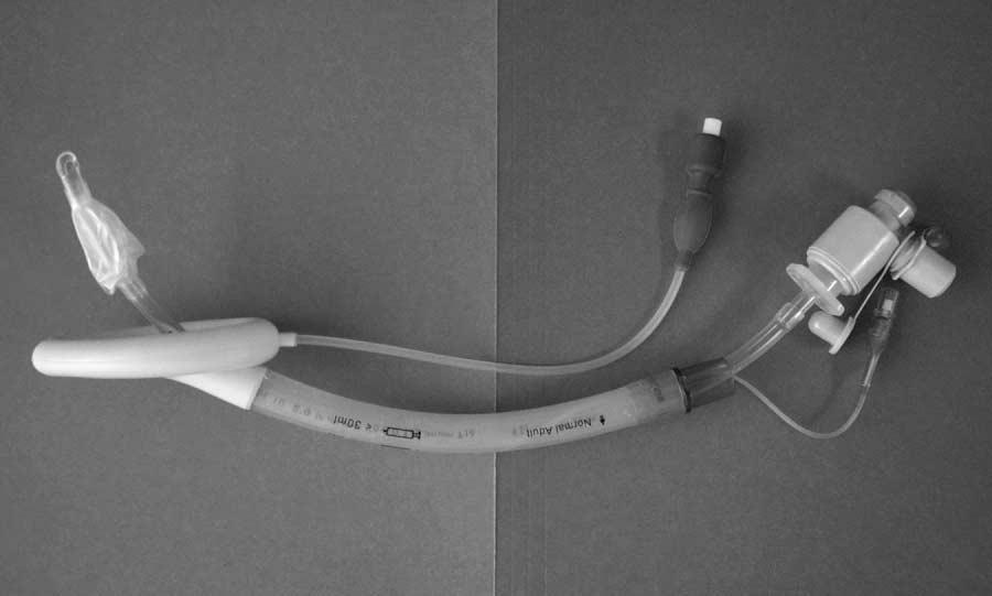 866 M.S. Bogetz / Anesthesiology Clin N Am 20 (2002) 863 870 Fig. 3. Insertion of the ETT into the LMA in preparation for fiberoptic intubation through the LMA. Note the swivel adapter on the ETT.
