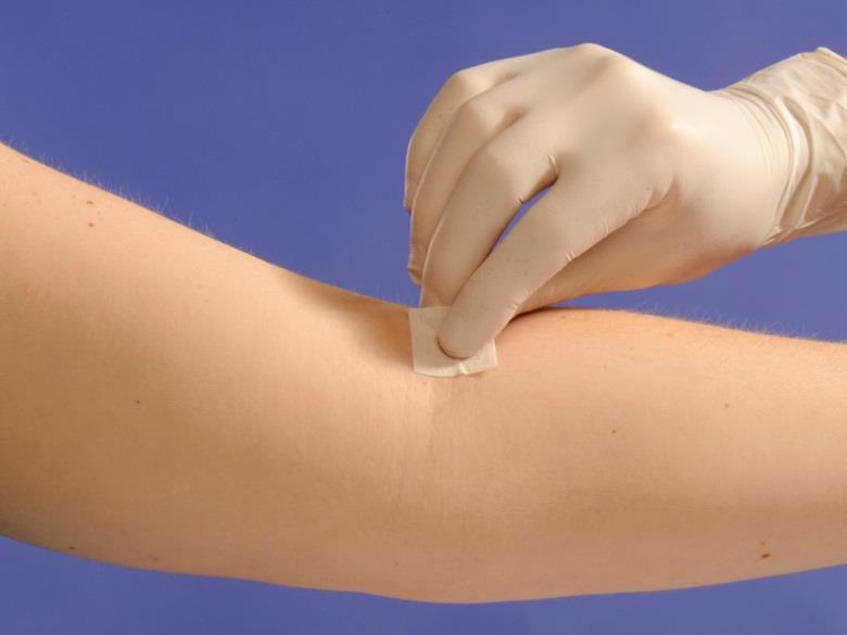 Venepuncture Place a pillow and absorbent sheet under patient`s arm Re-apply tourniquet Prepare skin by cleaning the area overlying the vein with an alcohol wipe.
