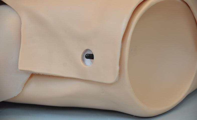 Press down on the white clip and disconnect the vest connector from the pacer module. Sternum Snap 3.