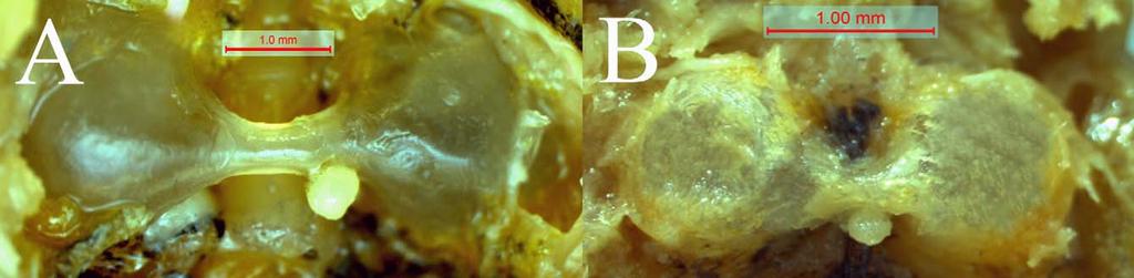 FIGURE 3. Air bladder of (A) Physoschistura tigrinum and (B) P.