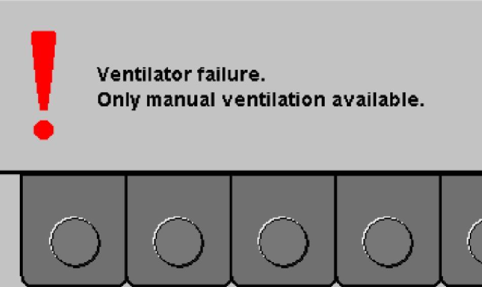 The ventilation soft keys are removed from the screen and a prompt appears advising the user how to proceed: