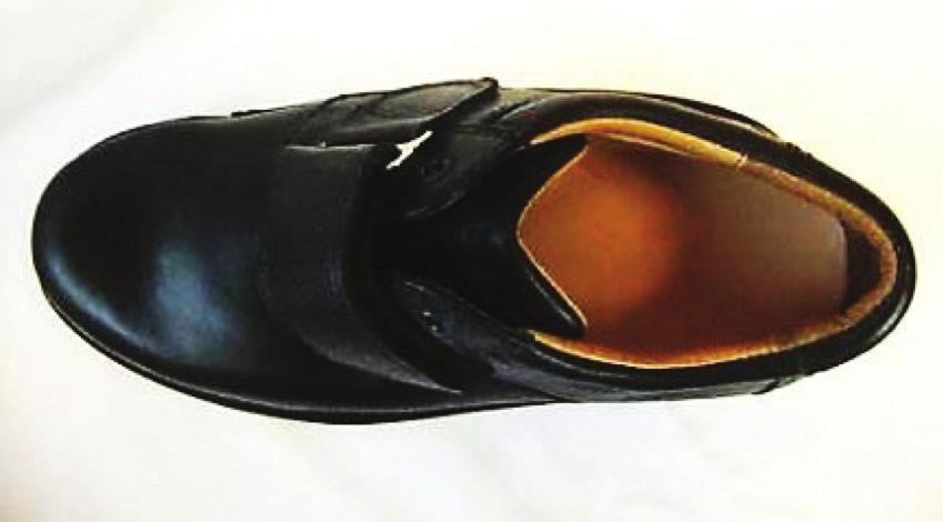 the shoe, possible excavations inside the shoe, and the addition of a rocker sole. Used to accommodate severe deformity and reduce pressure on the bottom of the foot.