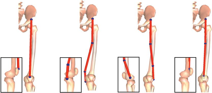 616 M.D. Fox et al. / Journal of Biomechanics 2 (29) 61 619 moment arm at the knee (cm) flex ext model experiment Fig. 2. Illustrations of the rectus femoris muscle (top panels) and its moment arm at the knee averaged over 2 61 of knee flexion (bottom panels).