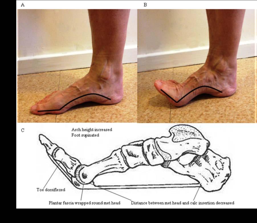 elevates Static /Standing Plantar fascia and intrinsic