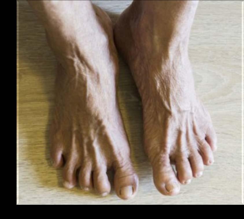 Static Feet