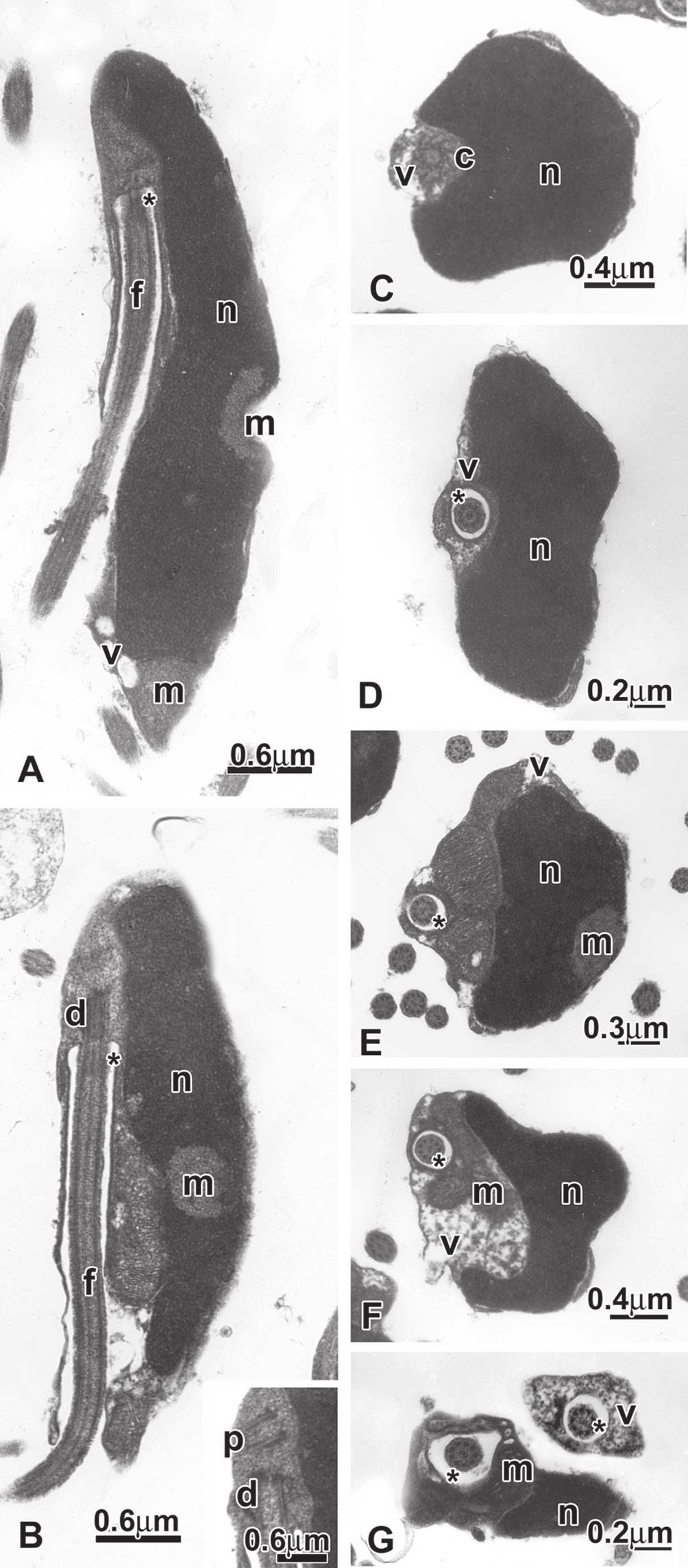 142 Menezes, N.A. et al.: Review of Monotocheirodon (Characiformes: Characidae) Figure 15: Spermatozoa of Monotocheirodon kontos, MUSM 6756, 38.1 mm SL. A, B: Longitudinal section of spermatozoa.