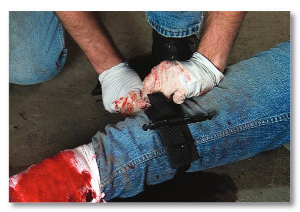 Take 5 Unit 3 Disaster Medical Operations Part 1 3-40 Controlling Bleeding with a Tourniquet When direct pressure is not possible or not effective at controlling heavy bleeding from a limb,