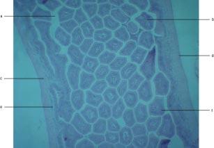 Ocean Surgeon Acanthurus bahianus Intestine Anterior section of intestine (100x). a) lumen. b) goblet cell. c) circular muscle layer. d) longitudinal muscle layer.