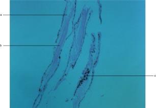 Ocean Surgeon Acanthurus bahianus Fin Fin (100x). a) epithelium. b) cartilage. c) melanophores. Fins are a common site of parasitism.