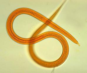 Nematoda Roundworms (24,773 known species) General