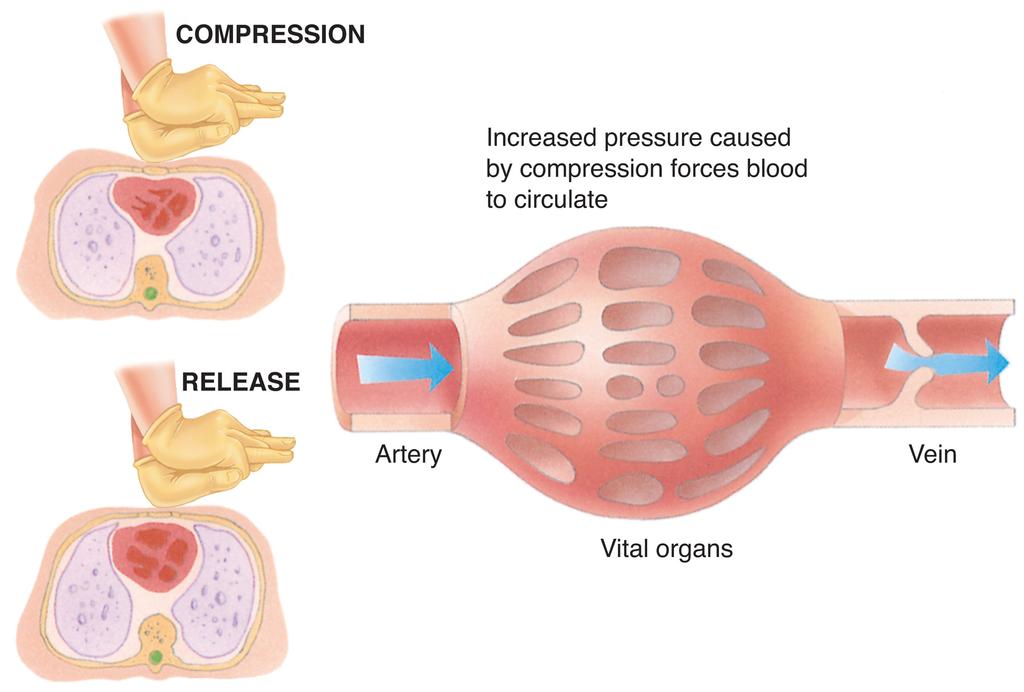 Quality Compressions are the foundation of High Quality CPR Compressions pump blood throughout the body. An immediate decrease in blood flow occurs anytime compressions are stopped.