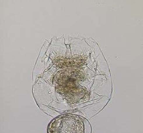 (356/l) of rotifers