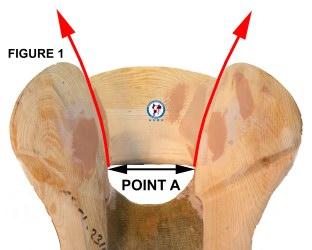 NOTE An inherent problem with saddle fit is that when checking the indicators and measurements for a positive or negative saddle fit the situation is static.