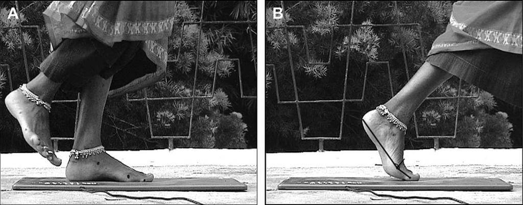 N.L. Griffin et al. / Journal of Human Evolution 59 (2010) 608e619 611 Figure 1. The MTPJ 1 angles of habitually shod and unshod individuals from India were digitized in ImageJ.