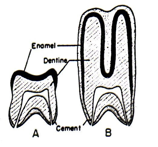 Figure 7. Left. Normal, low-crowned (a.) tooth vs. hypsodont (b.) condition.