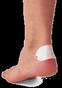 If you do get a blister, first aid treatment makes it possible to walk on a blister, in