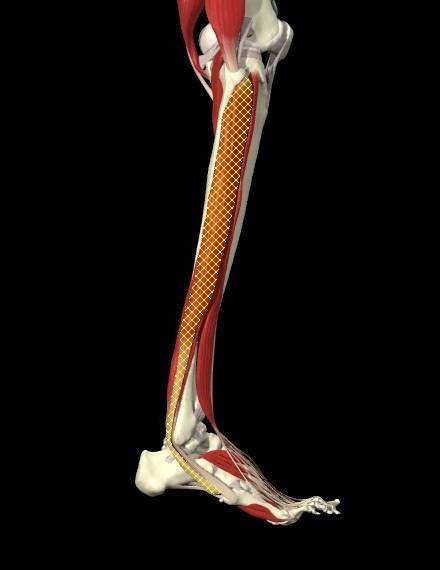 Overactive Muscles Peroneus Longus Lateral