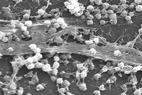 BIOFILMS A biofilm is any group of microorganisms in which cells stick to each other and often these cells adhere to a surface.