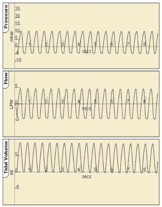 Figure 3 depicts the waveforms for conventional verses high frequency ventilation (3 a and b); the typical pressure graph for HFOV is therefore very different to what we see in conventional modes.