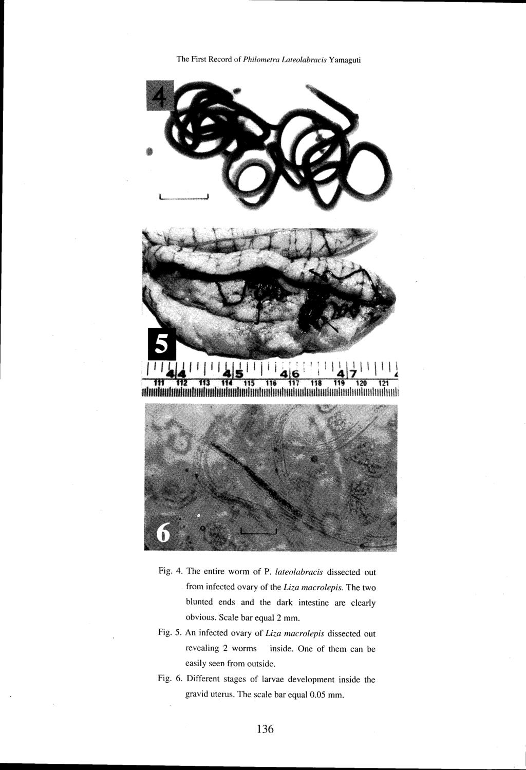 The First Record of Philometra Lateolabracis Y amaguti Fig. 4. The entire worm of P. lateolabracis dissected out from infected ovary of the Liza macrolepis.