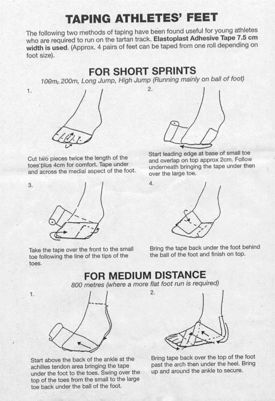 If athletes do not have suitable shoes, it is further recommended that the athlete s feet are taped before they compete.