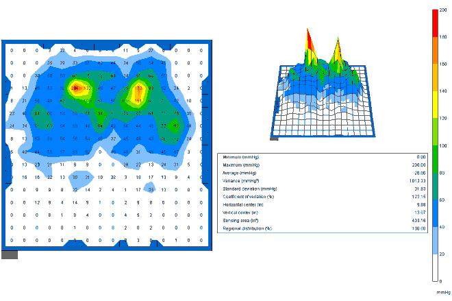 Interface Pressure Mapping (IPM) Clinical