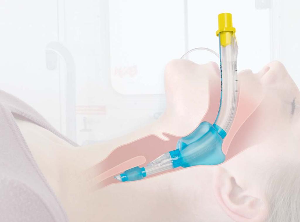 The 2nd generation supraglottic airway device Although the Laryngeal Tube family is well established, our products are continuously developed and clinically adjusted to ensure best possible patient
