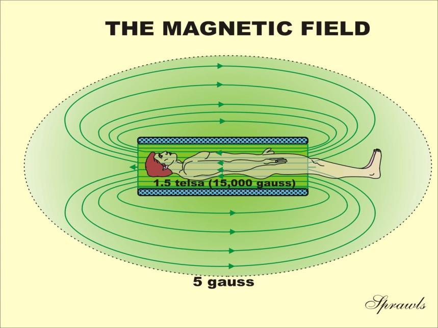 Magnetic Field Magnetic field is measured in gauss (G) or Tesla (T) units. 1 T = 10,000 G. The earth s magnetic field is about 0.5 G (0.00005T). Typically an MRI will have field strength between 1.