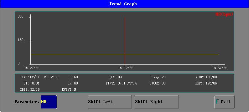 TREND GRAPH ANALYSIS TREND GRAPH ANALYSIS ADMITTANCE If want to choose the Trend Graph Analysis on trend management menu, click the button of trend graph to pop up the trend graph interface like the