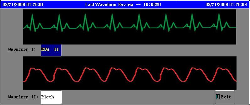THE LAST WAVEFORM REVIEW Click the item of Last Waveform to pop up the last waveform review window like the graph below: When there are waveforms display for demonstration or realtime