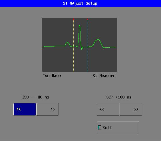 ST ADJUST After choosing, the menu below will appear (the graph is the obtained ST Segment module): ISO(Base Point) Set the baseline point, its adjustable range is 508ms~ 4ms, the default value is