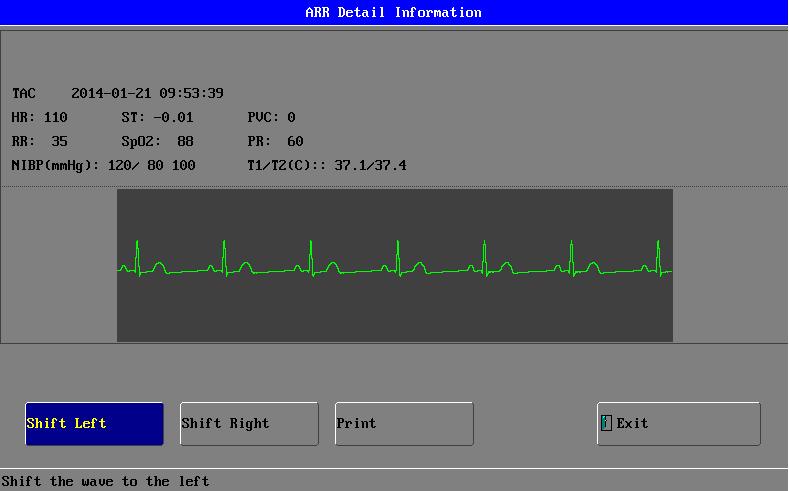 Figure 15: Window for ARR Retail Information 3. Rename: To rename a selected ARR item. 4. Delete: To delete a selected ARR item. 5. Sort: to sort the arrhythmia items by Time or Type.
