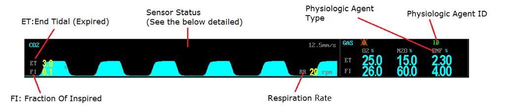 ANESTHETIC AGENT DISPLAY DISPLAY Open the DRAGER Gas module and then choose to display Gas waveform in the Waveform Select menu. See graph below.