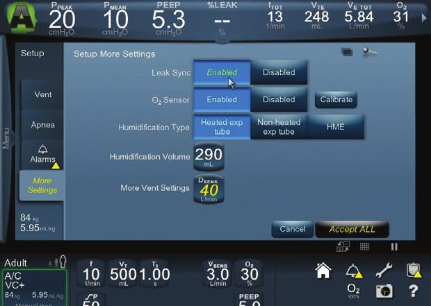 This unique software is designed to differentiate between flow due to leaks and flow due to patient respiratory effort and then to adjust quickly.