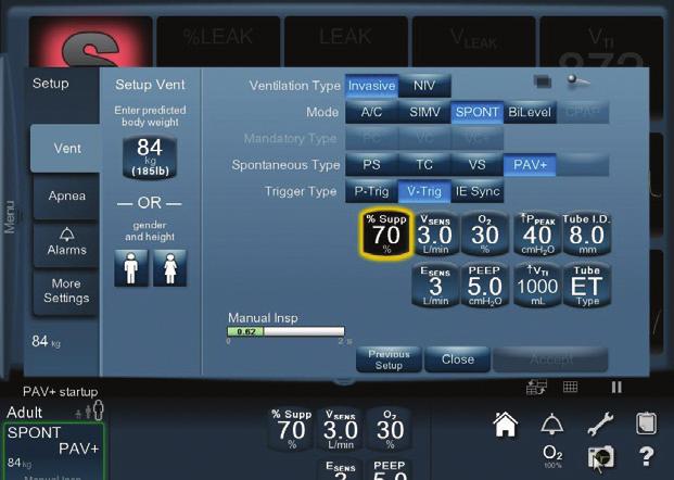 PAV * + SOFTWARE QUICK REFERENCE GUIDE Puritan Bennett 980 Ventilator KEY FEATURES The PAV * + software provides ventilatory support proportional to the patient s inspiratory effort, letting the