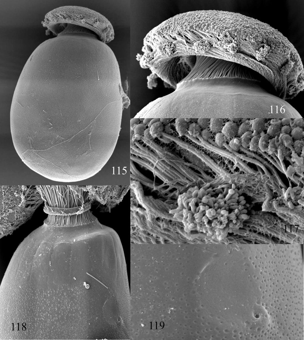 FIGURES 115 119. Egg structure of Derlethina eloisae (SEM pictures). Fig. 115: Shape of the egg; Fig. 116: Detail of the polar cap; Fig.
