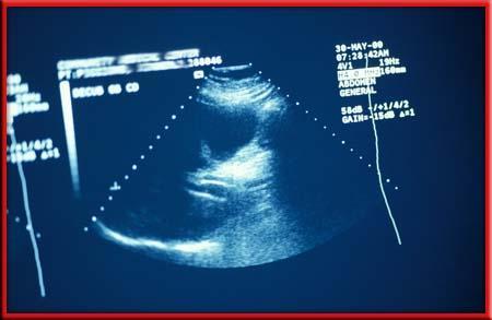 11.4 Using Sound Ultrasound in Medicine Reflected ultrasonic waves are used to detect