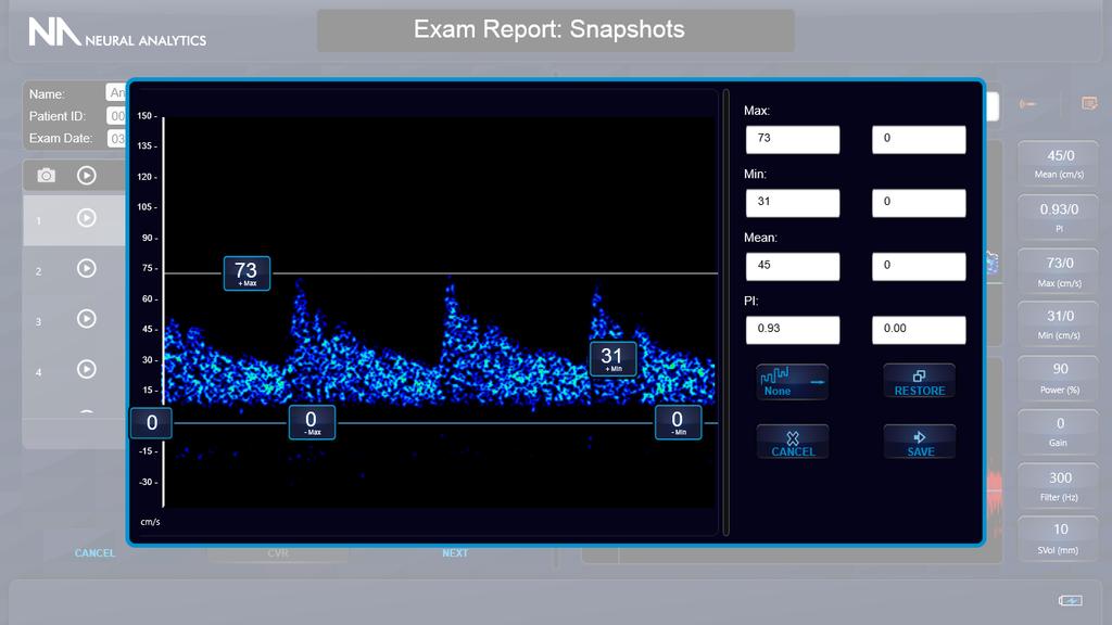 Snapshot Editing 1. Snapshot spectrograms can be edited on the Exam Report Screen 2. Select the snapshot to be edited and press the edit button. 3.
