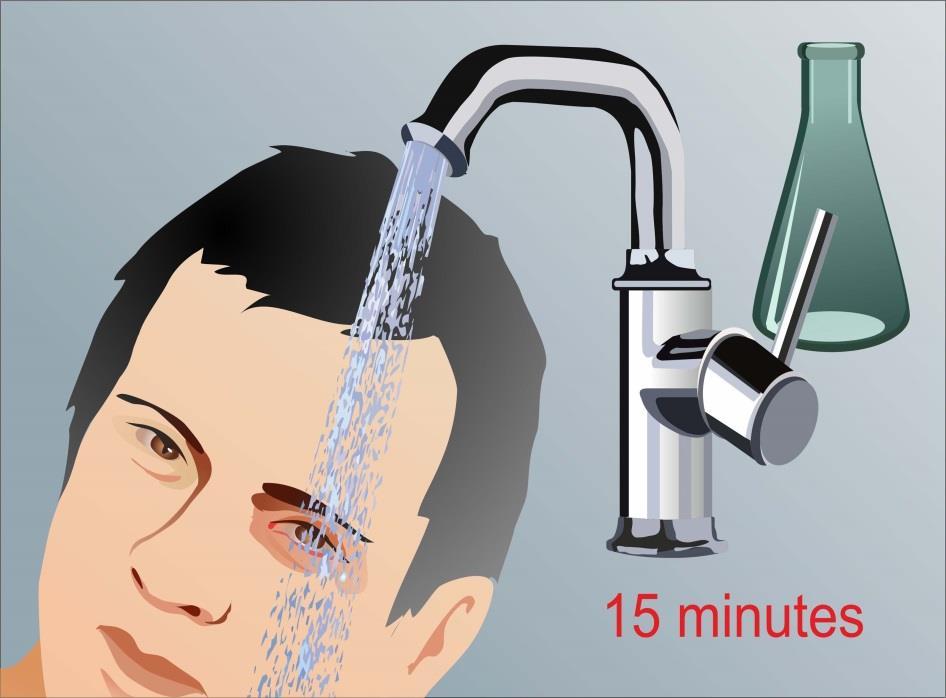 CHEMICALS IN THE EYE Flush with cool tap water right away. Turn the person's head so the injured eye is down and to the side.